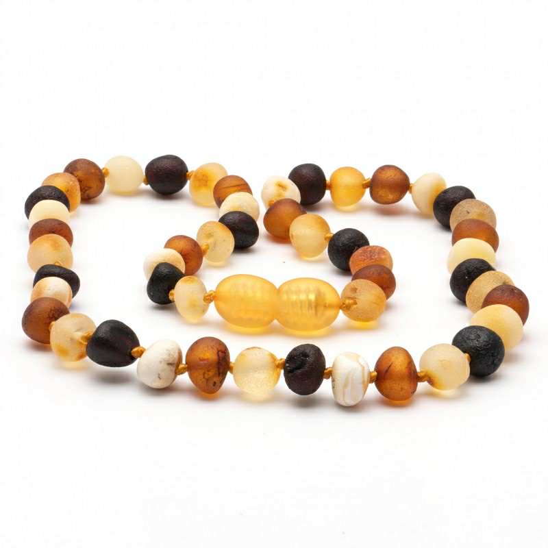 Zebra Babies Amber Necklace 32cm